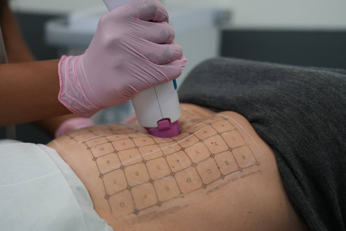 Non-invasive beauty treatments, by beauty blogger What The Fab